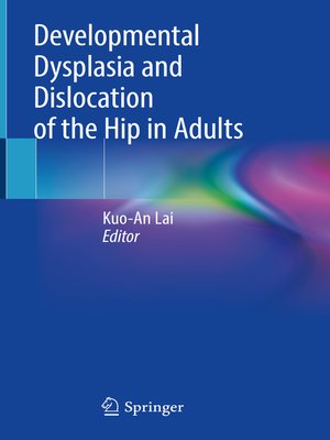 cover image of Developmental Dysplasia and Dislocation of the Hip in Adults